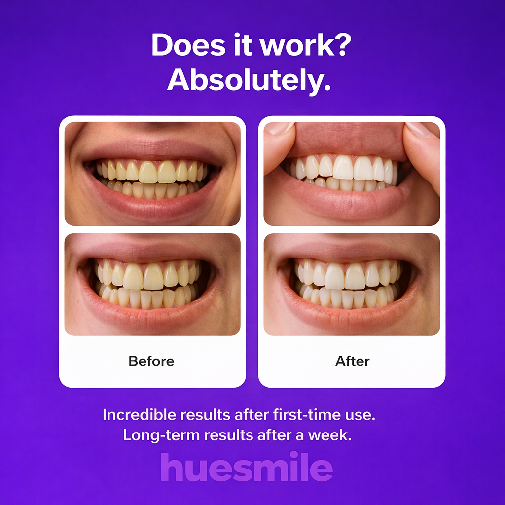 HueSmile Whitening Strips